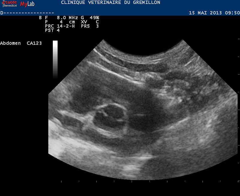 Coupe trans-aortique centrée sur le tronc pulmonaire