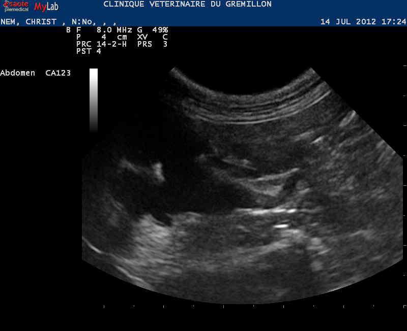 Rein: dilatation modérée du bassinet, hydronephrose