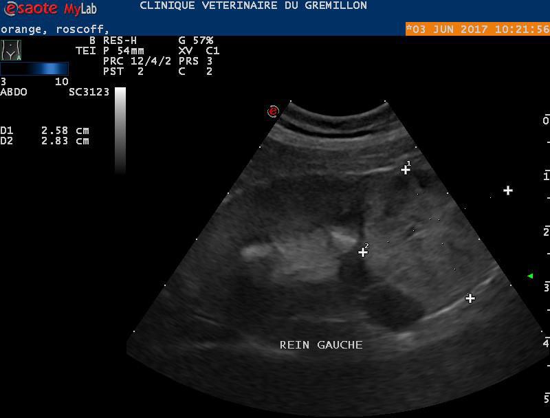 Rein: tumeur au pôle caudal du rein (metastase probable)