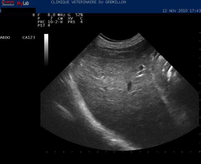 Fibrose ou lipidose hepatique