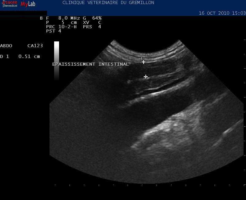 Epaississement de la musculeuse intestinale