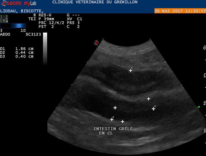 Epaississement de la musculeuse intestinale