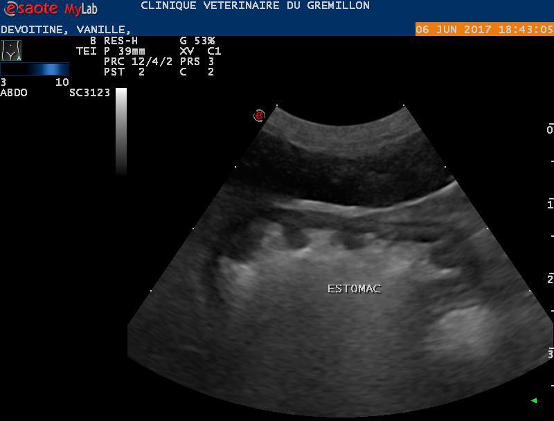 Estomac normal