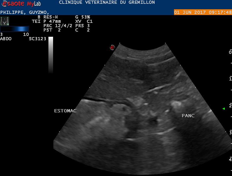 Pancreas visible mais d'échogénicité normale