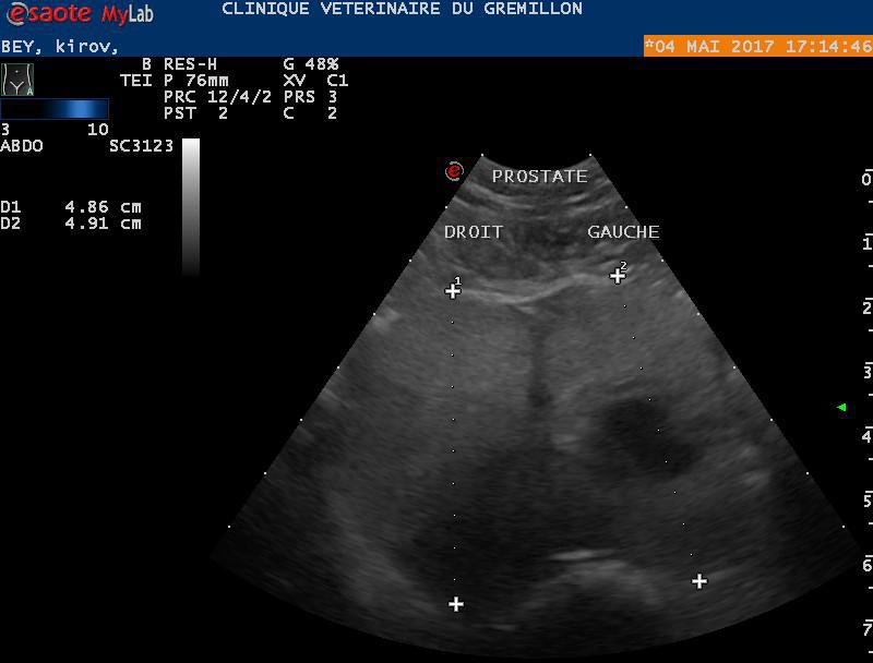 même nodule en coupe transversale