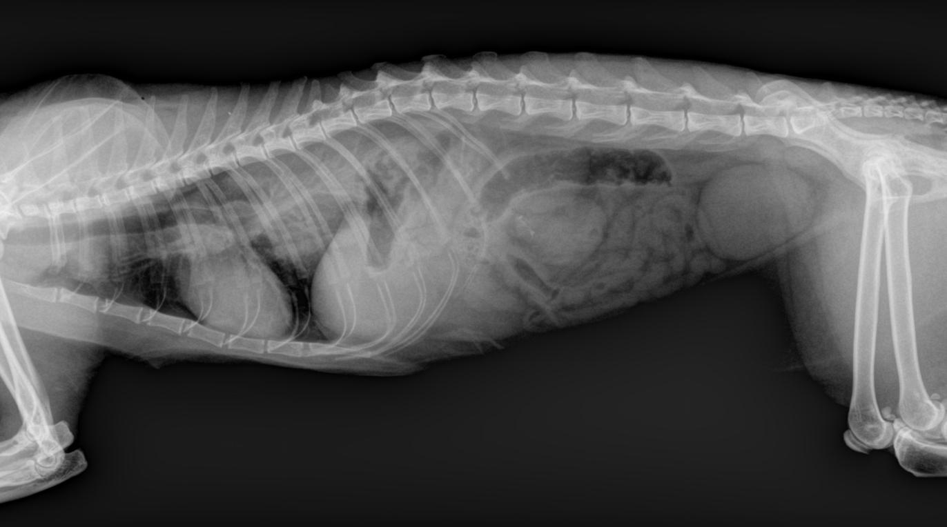 Opacité d'un lobe dorso caudal