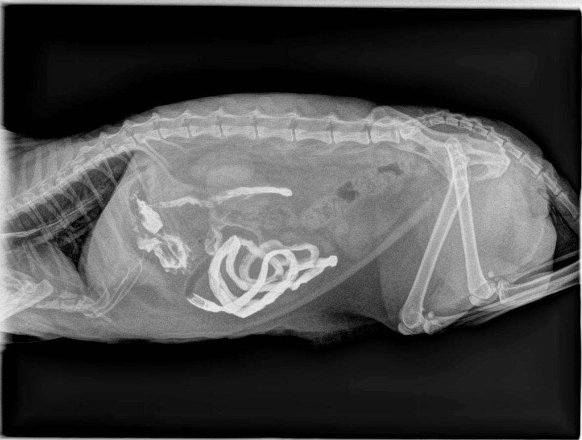 Transit baryté à la recherche d'une occlusion intestinale