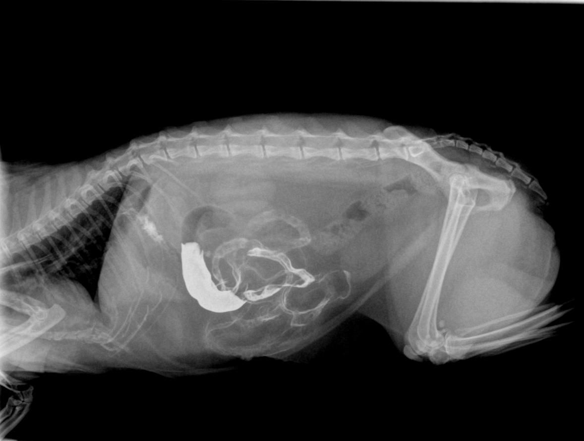 Transit baryté à la recherche d'une occlusion intestinale