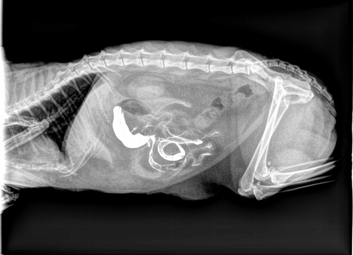 Transit baryté à la recherche d'une occlusion intestinale