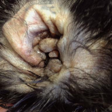 Otite chronique sténosante