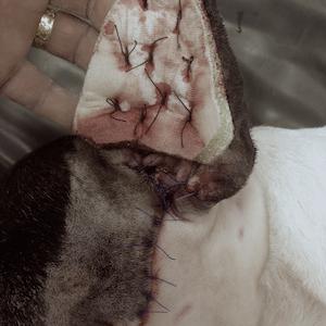 Suture d'une compresse après vidange de l'othématome