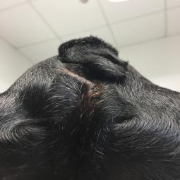 Hernie avant chirurgie