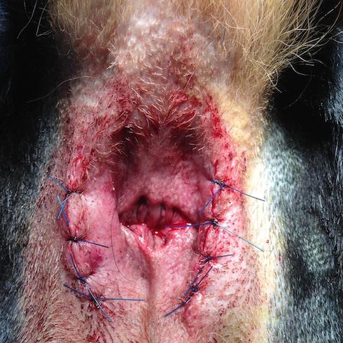 Sutures post-opératoires