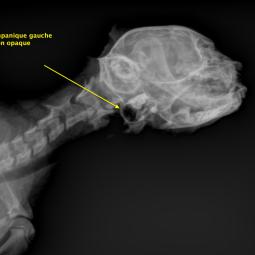 Radio de profile pour l'exploration de la bule tympanique gauche