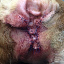 Oreille après chirurgie