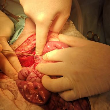 Chirurgie: pose d'un cellophane