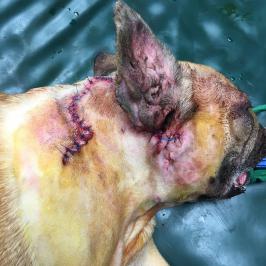 Transposition d'un lambeau cutané du cou vers la nuqye