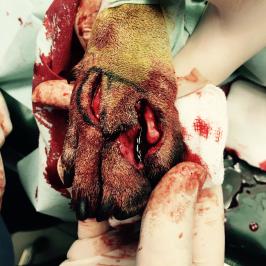 transposition lambeau cutané 