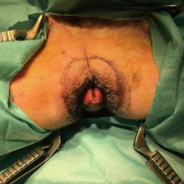 Intertrigo au niveau du pli vulvaire d'une chienne