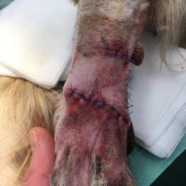 Après suture et transposition d'un lambeau cutané